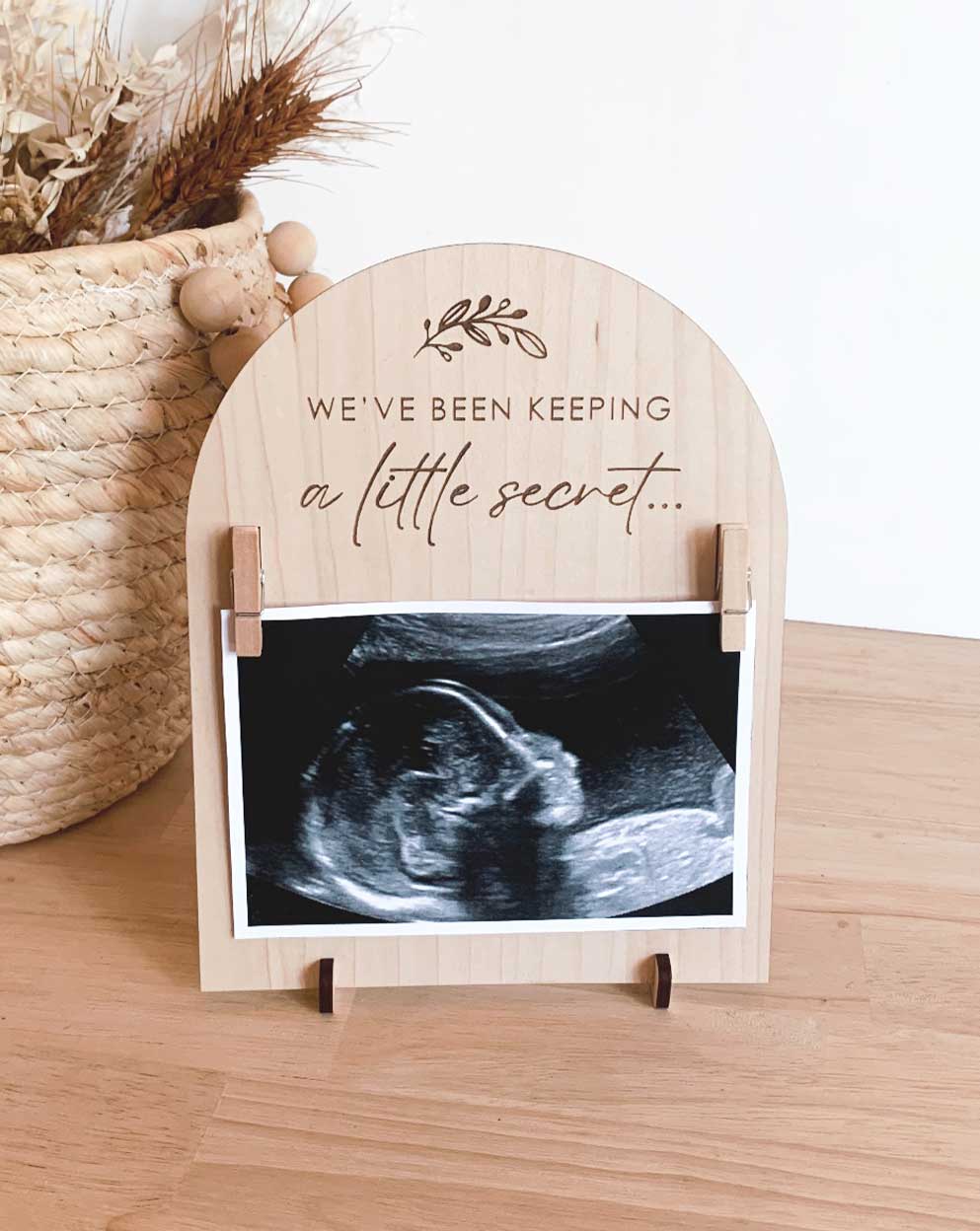 Ultrasound Birth Announcement Plaques - Bulk Order
