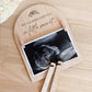 Ultrasound Birth Announcement Plaques - Bulk Order