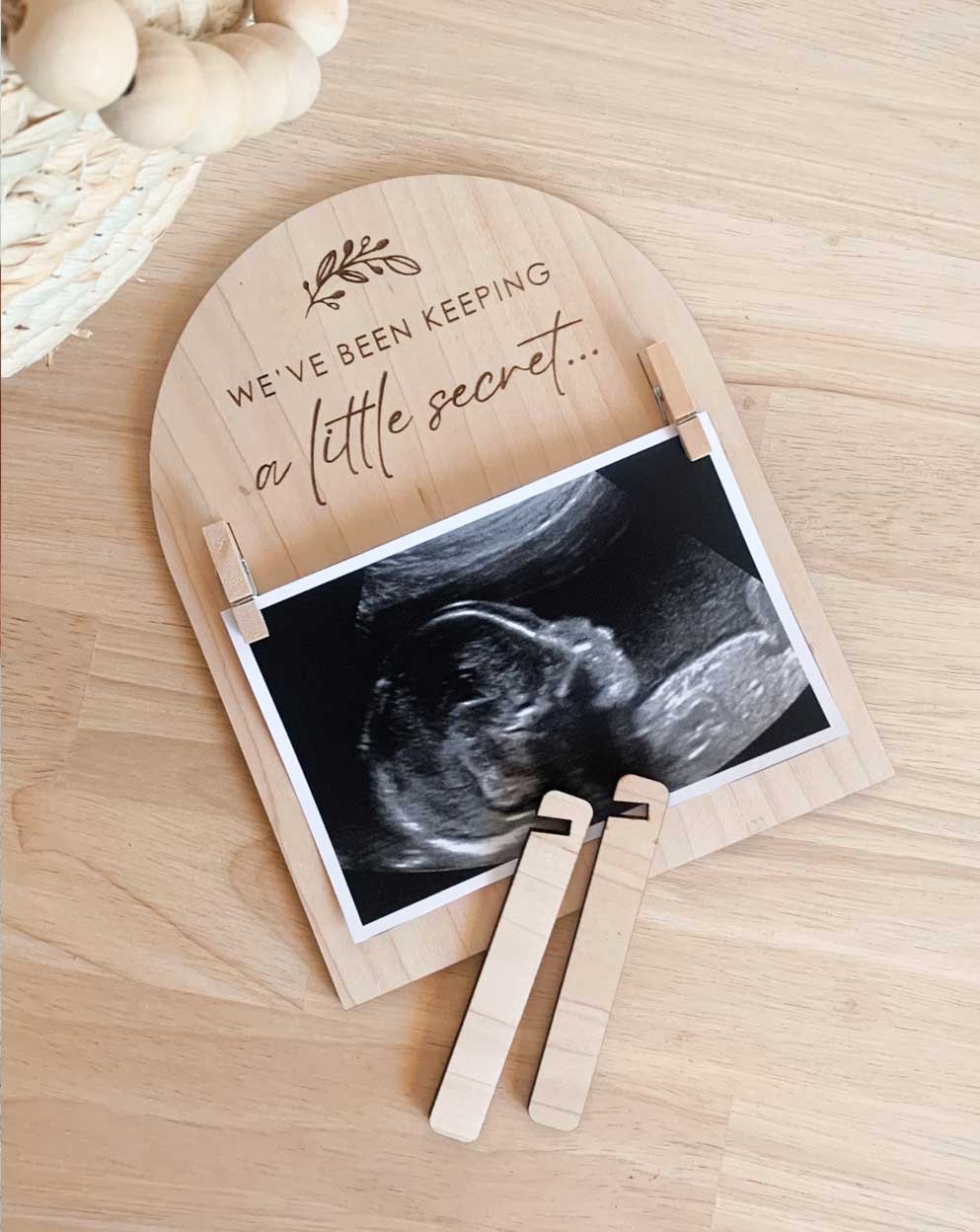 Ultrasound Birth Announcement Plaques - Bulk Order